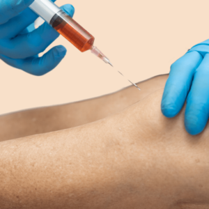 Injection_ Knee, Shoulder, Elbow