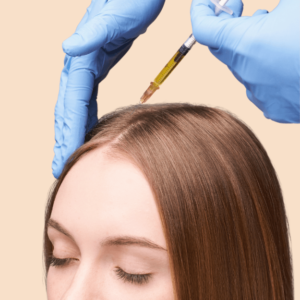 PRP Hair Restoration
